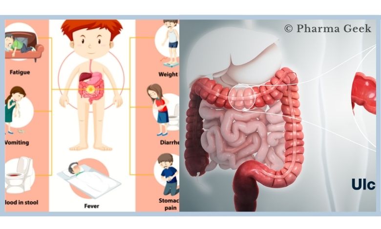 Crohn’s Disease and Ulcerative Colitis